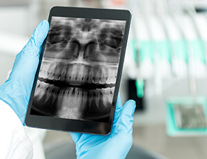X-rays viewed on tablet