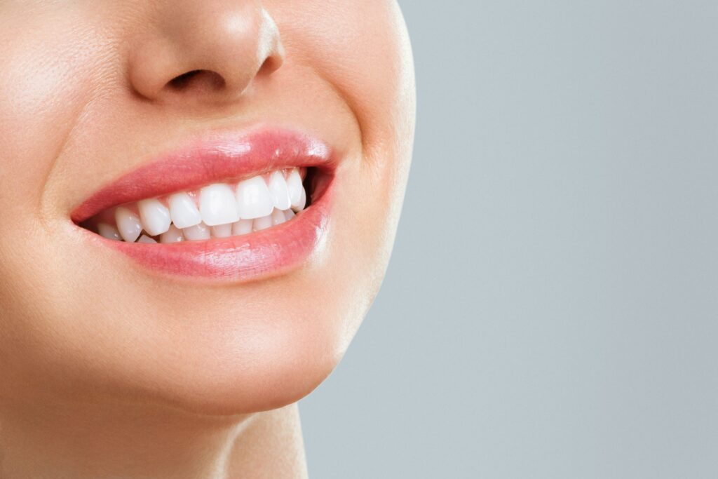 Nose-to-neck 3/4 profile view of woman smiling with bright teeth